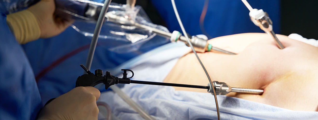 General & Laparoscopic Surgery