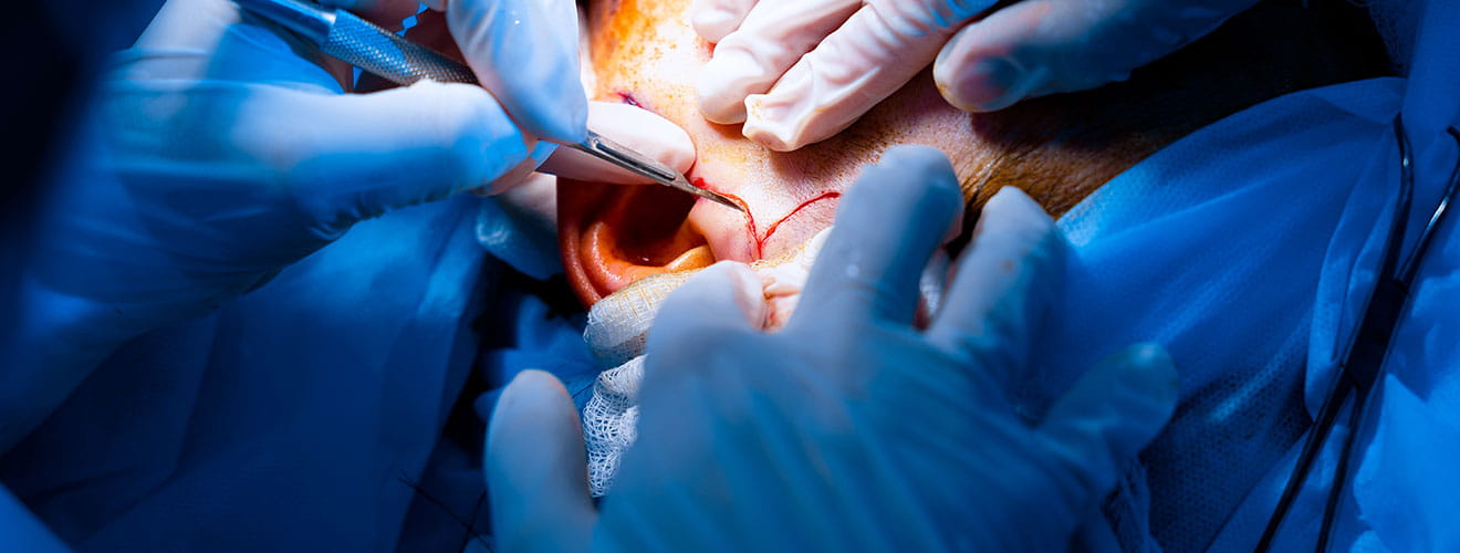 ENT, Head & Neck Surgery